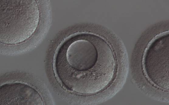 <p><strong>Figure 49</strong></p><p>Vacuolated oocyte. This oocyte has a single large vacuole occupying almost half of the oocyte cytoplasm (200× magnification).</p>