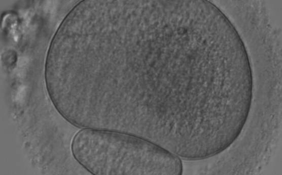 <p><strong>Figure 78</strong></p><p>MII oocyte with a giant PBI.</p>