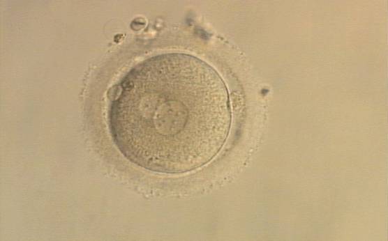 <p><strong>Figure 108</strong></p><p>A zygote generated by ICSI with one large and one normal-sized PN (200× magnification). The two polar bodies are at opposite sides of the oocyte.</p>