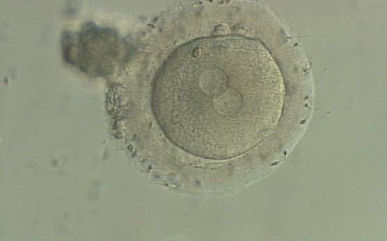 <p><strong>Figure 131</strong></p><p>A zygote generated by IVF with a thick ZP (400× magnification). PNs are juxtaposed in the cytoplasm, which has a clear cortical zone. NPBs are small and aligned in one PN and scattered in the other. A refractile body is visible at the 11 o'clock position in this view.</p>