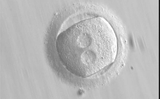 <p><strong>Figure 136 (a)</strong></p><p>A zygote with an irregular shape, generated by ICSI and observed 18 h post-ICSI (400× magnification). The polar body had been biopsied. PNs are widely separated and contain scattered small NPBs.</p>