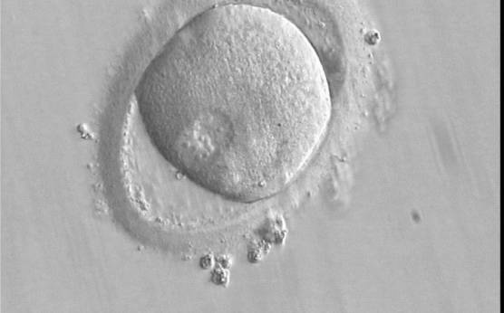 <p><strong>Figure 145</strong></p><p>A zygote observed 16 h post-ICSI with peripherally positioned PNs (400× magnification). A large PVS is present inside a deformed, ovoid ZP. The oocyte has a clear cortical zone in the cytoplasm. It was not transferred because of arrested development.</p>