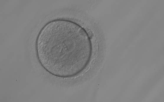 <p><strong>Figure 151</strong></p><p>A zygote observed 18 h post-ICSI with equal numbers of NPBs aligned at the PN junction (200× magnification). It was transferred but the outcome is unknown.</p>