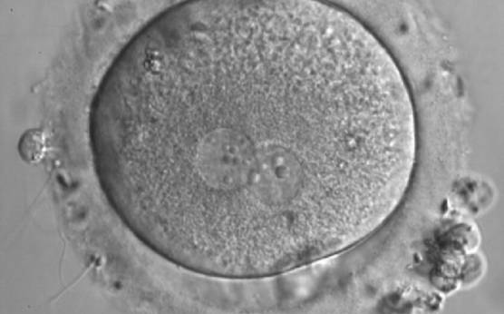 <p><strong>Figure 161</strong></p><p>A zygote generated by IVF with inequality in numbers and alignment of NPBs (600× magnification). It was discarded.</p>