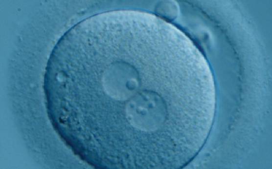 <p><strong>Figure 187</strong></p><p>Zygote generated by ICSI with one ‘bull's eye’ NPB in one PN and small, different-sized NPBs in the other (400× magnification). It was transferred but clinical outcome is unknown.</p>