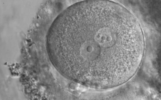 <p><strong>Figure 188</strong></p><p>Zygote generated by ICSI displaying two centrally positioned PNs: in one PN there is a single large NPB (‘bull's eye’), whereas the NPBs are smaller, different-sized and scattered in the other (600× magnification). It was discarded.</p>