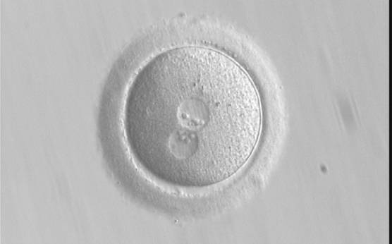 <p><strong>Figure 191</strong></p><p>A zygote generated by ICSI, which subsequently underwent polar body biopsy, shows normal cytoplasmic morphology (400× magnification). It was discarded due to aneuploidy.</p>