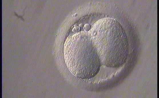<p><strong>Figure 212</strong></p><p>The first embryo division nearing completion but the two daughter cells are still not separated. This should be assessed as a 2-cell embryo.</p>