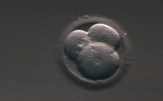 <p><strong>Figure 214</strong></p><p>A 3-cell embryo with one larger blastomere and two smaller blastomeres, i.e. it has a stage-specific cell size (see Section C). The embryo was generated by ICSI but was not transferred.</p>
