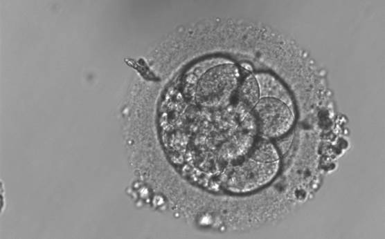 <p><strong>Figure 238</strong></p><p>A 6-cell embryo with 30–40% concentrated fragmentation and a thick ZP. It was generated by ICSI but was not transferred.</p>