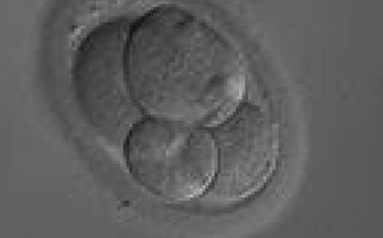 <p><strong>Figure 250</strong></p><p>A 4-cell embryo with unevenly sized and irregular blastomeres with two blastomeres being larger than the other two. The blastomeres are not stage-specific cell size. Note that the ZP of this embryo is elongated.</p>