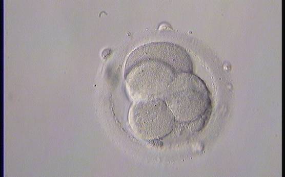 <p><strong>Figure 258</strong></p><p>A 5-cell embryo with two large and three small blastomeres instead of three large and two small blastomeres; therefore, not stage-specific cell size.</p>