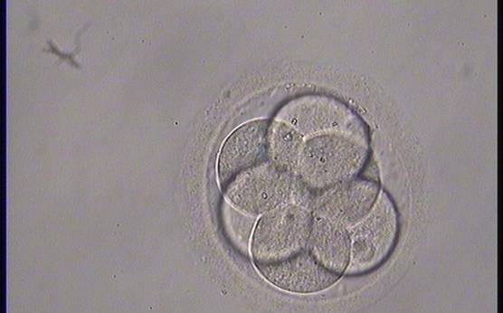 <p><strong>Figure 261</strong></p><p>A thawed 6-cell embryo with six blastomeres of the same size rather than two large and four smaller blastomeres; therefore, not stage-specific cell size.</p>