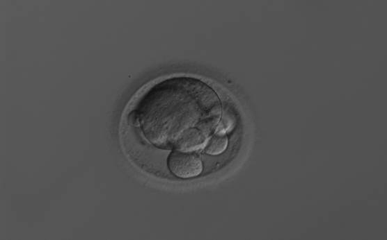 <p><strong>Figure 262</strong></p><p>A 6-cell embryo with two very large and four very small blastomeres. The extreme size difference between the large and small blastomeres makes this embryo not stage specific.</p>