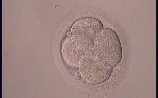 <p><strong>Figure 268</strong></p><p>A 4-cell embryo with one binucleated blastomere.</p>