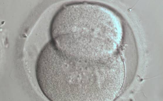 <p><strong>Figure 270</strong></p><p>A 2-cell embryo with blastomeres of unequal size with several (four) nuclei in one blastomere.</p>