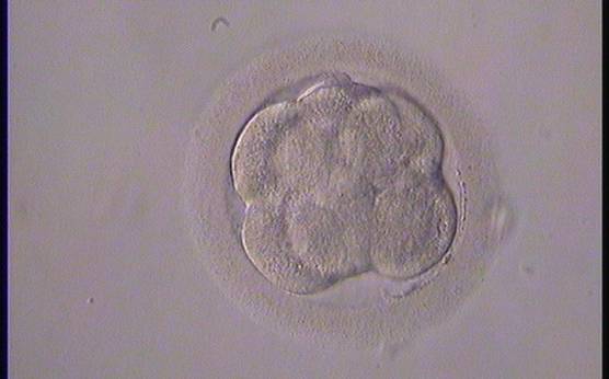 <p><strong>Figure 293</strong></p><p>An 8-cell embryo showing signs of moderate compaction. Individual blastomeres are becoming difficult to identify.</p>