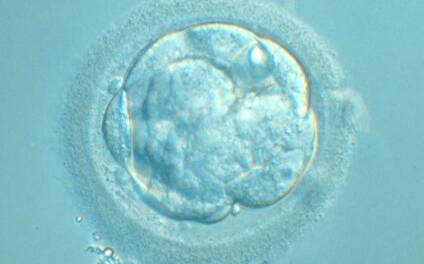 <p><strong>Figure 302</strong></p><p>Embryo showing early cavitation. An initial blastocoele cavity is beginning to appear. The ZP is broken after blastomere biopsy.</p>