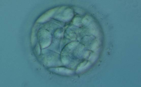 <p><strong>Figure 306</strong></p><p>An early blastocyst with a cavity occupying <50% of the volume of the embryo. Note the flattened squamous-like trophectoderm (TE) cells lining the left half of the cavity in this view. The blastocyst was transferred but failed to implant.</p>