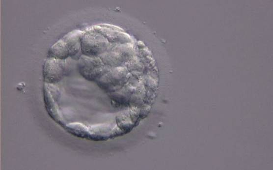 <p><strong>Figure 309</strong></p><p>An early blastocyst with the cavity clearly visible and occupying half the volume of the embryo. The blastocyst was transferred but the outcome is unknown.</p>