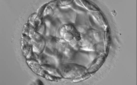 <p><strong>Figure 310</strong></p><p>An early blastocyst with the cavity occupying >50% of the volume of the embryo. The overall volume of the blastocyst remains unchanged with no thinning of the ZP. The large cellular debris does not take part in the blastocyst formation.</p>