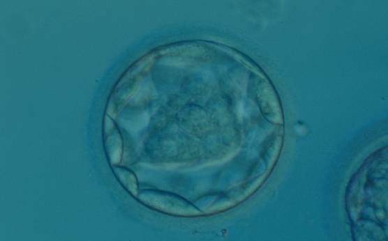 <p><strong>Figure 320</strong></p><p>Blastocyst (Grade 3:1:1) with a dense, almost triangular, ICM clearly visible at the base of the blastocyst in this view. The blastocyst was transferred but failed to implant.</p>