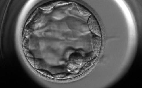 <p><strong>Figure 347</strong></p><p>Blastocyst (Grade 3:2:1) showing a compact ICM at the 5 o'clock position in this view. The ICM is very small and made up of only a few cells. The blastocyst was transferred but the outcome is unknown.</p>
