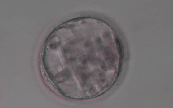 <p><strong>Figure 351</strong></p><p>Blastocyst (Grade 3:3:3) with no clearly identifiable ICM and sparse TE that does not form a cohesive epithelium.</p>