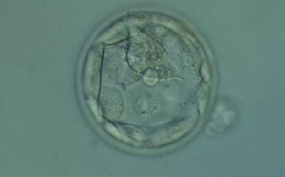 <p><strong>Figure 370</strong></p><p>Hatching blastocyst (Grade 5.1.2) with few TE cells that form a loosely cohesive epithelium, and with a mushroom-shaped ICM at the 12 o'clock position in this view. The blastocyst was transferred but failed to implant.</p>