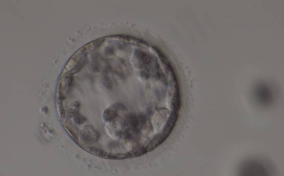 <p><strong>Figure 382</strong></p><p>Poor quality, degenerating, early blastocyst in which the majority of cells are showing dark, degenerative changes.</p>