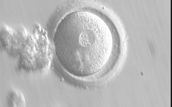 <p><strong>Figure 90</strong></p>

<p>A zygote observed 15 h post-IVF displaying a single, large-sized PN and two polar bodies (400× magnification).</p>