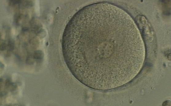 <p><strong>Figure 96</strong></p>

<p>A zygote displaying 3PNs of approximately the same size with large-sized NPBs, partly overlapped and aligned in the middle of the oocyte (400× magnification). It was generated by IVF and shows two polar bodies.</p>