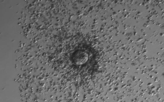 <p><strong>Figure 5.</strong> A cumulus oocyte complex at low magnification. The oocyte is surrounded by an expanded cumulus–corona cell complex clearly showing the separation of individual CCs due to the accumulation of hyaluronic acid in the extracellular space.</p>