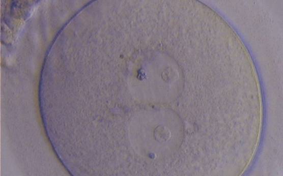 <p><strong>Figure 26</strong></p><p>Giant oocyte with two apparent GVs (centrally located and juxtapposed). This tetraploid oocyte originates from the fusion of two separate oocytes and is usually tetraploid (400× magnification).</p>