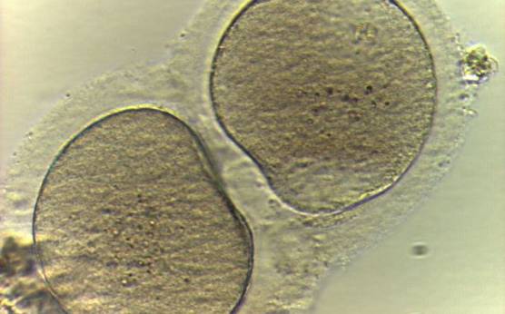 <p><strong>Figure 35</strong></p><p>Two oocytes enclosed within a single ZP (400× magnification).</p>