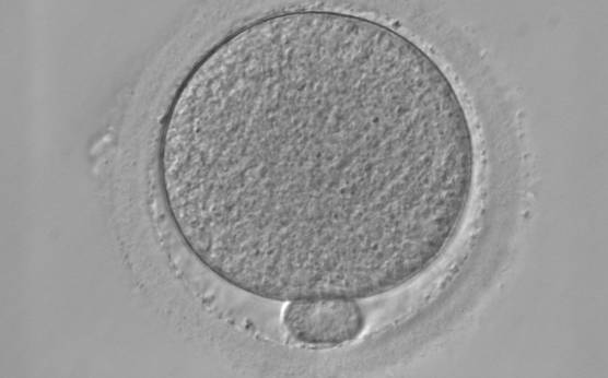<p><strong>Figure 40</strong></p><p>MII oocyte with granular cytoplasm. This figure can be considered as a slight deviation from normal homogeneous cytoplasm (400× magnification).</p>