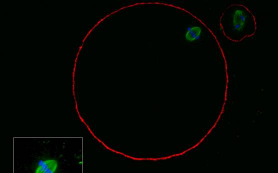 <p><strong>Figure 52</strong></p><p>MII oocyte with a normal-shaped MS observed using confocal microscopy.</p>