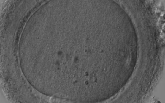 <p><strong>Figure 63</strong></p><p>MII oocyte with a thick and dark ZP. Some inclusions are visible in the ooplasm.</p>