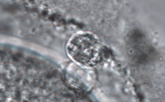 <p><strong>Figure 81</strong></p><p>MII oocyte with a fragmented PBI (two pieces) (magnification ×1000).</p>