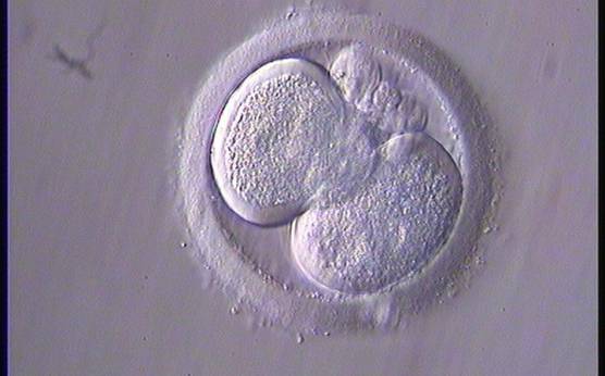 <p><strong>Figure 273</strong></p><p>A 2-cell embryo with a clear halo in both blastomeres, characterized by centralized granularity associated with an absence of organelles in the peripheral cortex.</p>
