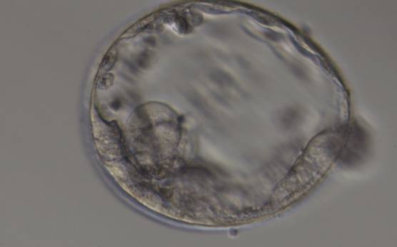 <p><strong>Figure 352</strong></p><p>Expanded blastocyst (Grade 4:3:3) with no clearly identifiable ICM. TE is made up of a few, sparse cells that do not form a cohesive epithelium.</p>