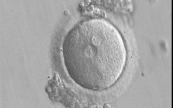 <p><strong>Figure 103</strong></p><p>A zygote generated by IVF using frozen/thawed ejaculated sperm and observed 16 h post-insemination (400× magnification). PNs are smaller than normal and are not exactly positioned in the centre of the oocyte. Small-sized NPBs are aligned at the PN junction. It was transferred and implanted.</p>