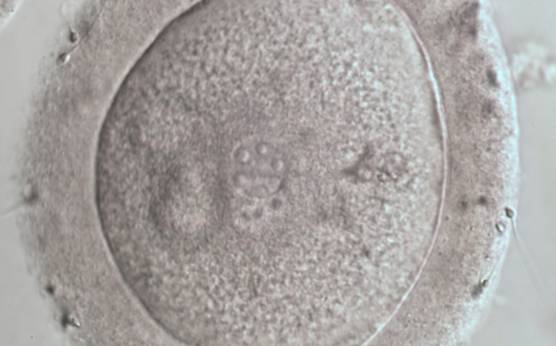 <p><strong>Figure 104</strong></p><p>A zygote displaying two small PNs partly overlapping in this view (600× magnification). NPBs are large in size, equal in numbers and scattered in the two PNs. The ZP appears thickened and the PVS almost absent.</p>