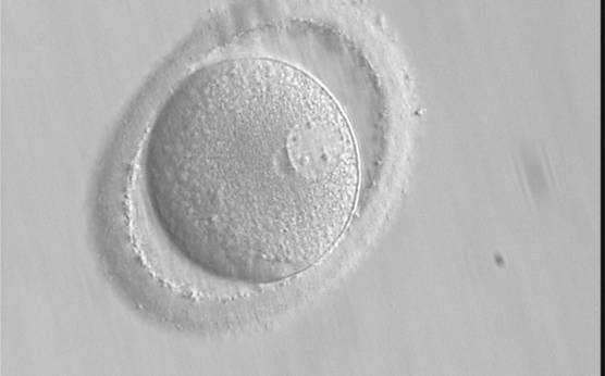<p><strong>Figure 109</strong></p>

<p>A zygote after PB biopsy showing peripheral PNs that are very different in size with one larger and one smaller than the normal size (400× magnification). The ZP is oval in shape.</p>
