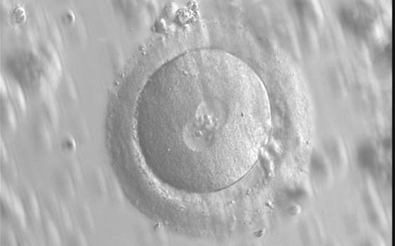 <p><strong>Figure 115</strong></p><p>A zygote with an equal number of large-sized NPBs aligned at the PN junction (400× magnification). PNs are juxtaposed and centralized and the polar bodies are located parallel to the longitudinal axis through the PNs. Observed 16 h after IVF.</p>