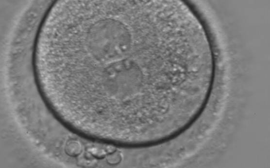 <p><strong>Figure 128</strong></p><p>A zygote with two centrally located and juxtaposed PNs, an enlarged PVS and a significant amount of debris in the PVS (400× magnification). It was transferred but the result is unknown.</p>