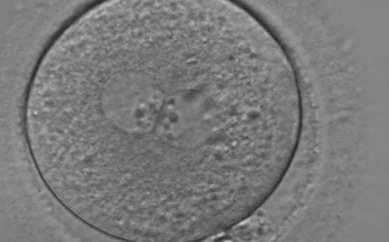 <p><strong>Figure 129</strong></p><p>A zygote with two centrally located and perfectly juxtaposed PNs in a granular cytoplasm with a clear cortical zone (400× magnification). NPBs are aligned, but are different in size. It was transferred but failed to implant.</p>