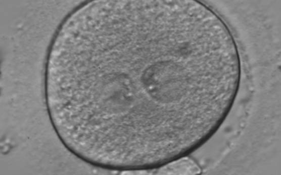 <p><strong>Figure 133</strong></p><p>A zygote generated by ICSI using fresh epididymal sperm, observed 18 h post-insemination (400× magnification). PNs are not juxtaposed, different in size and NPBs are symmetrically distributed. It was transferred but failed to implant.</p>