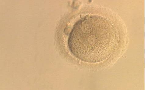 <p><strong>Figure 135</strong></p><p>A zygote generated by ICSI and observed at 16, 17.5, 19 and 22 h after insemination (200× magnification). The two PNs are peripherally located, widely separated and have an unequal number of scattered NPBs. It was discarded.</p>