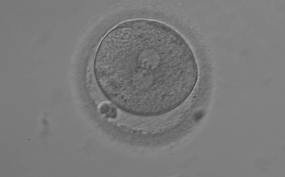 <p><strong>Figure 140</strong></p><p>A zygote with equal numbers of large-sized NPBs aligned at the PN junction (200× magnification). PNs are juxtaposed and centralized; polar bodies are aligned tangential to the longitudinal axis through the PNs.</p>